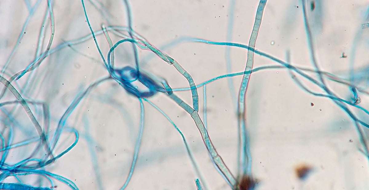 1536px-Fungal_hyphae
